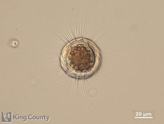 Photo of Mesodinium rubrum